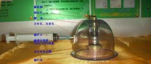 南昌正昌按摩技术学校(拔罐)